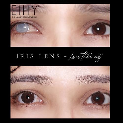 Lens thẩm mỹ tròng đen